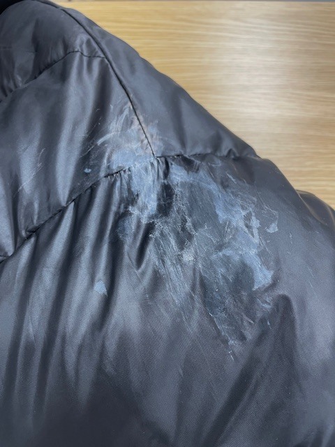 左肩から袖にかけてネイルグルーのシミが付いて固まってしまった黒いダウンジャケットの染み抜きクリーニング事例(７，７００円税込)2026.04.03