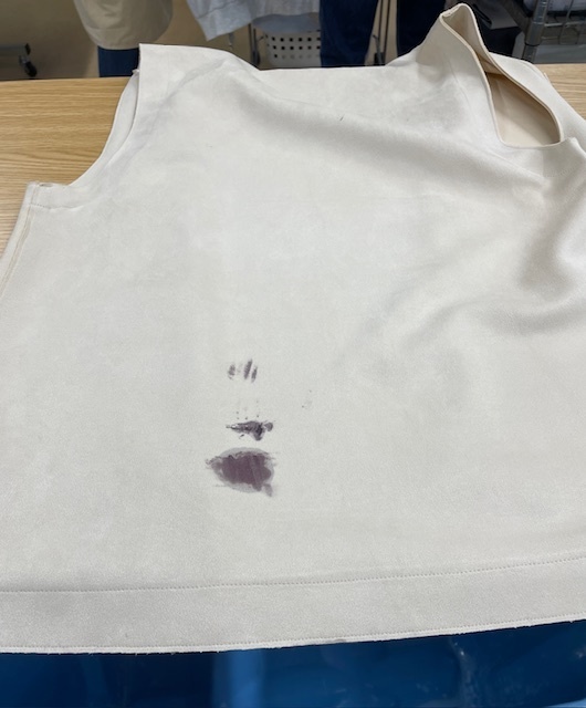 アイボリーのポリエステルベストに付いた濃いヘアカラーがキレイに落ちた染み抜きクリーニング事例（４，４００円税込）2025.12.06